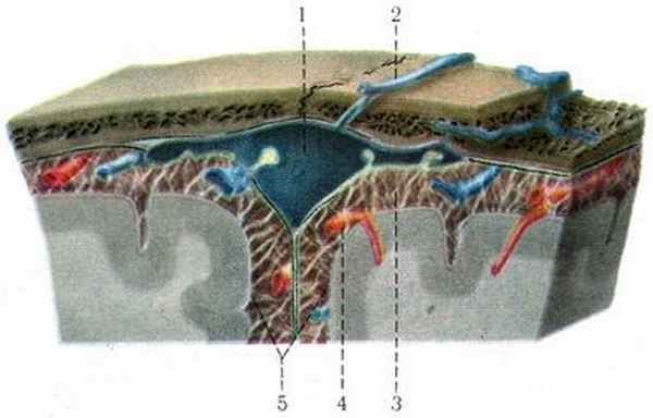 Паутинная оболочка. Грануляции паутинной оболочки головного мозга. Пахионовы грануляции паутинной оболочки. Пахионовы грануляции гистология. Ямочки грануляций паутинной оболочки.