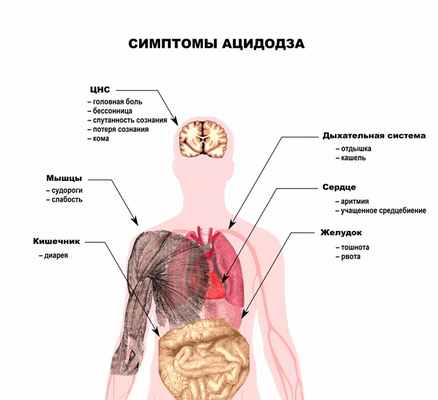 Симптомы ацидоза.jpg