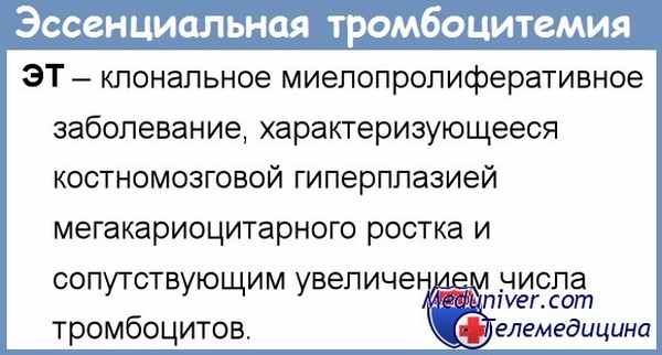 Лечение тромбоцитемии