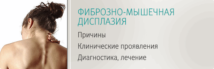 Мышечная дисплазия. Фиброзно-мышечная дисплазия. Фибромышечная дисплазия. Фиброзно-мышечная дисплазия диагностика. Фибромускулярная дисплазия.