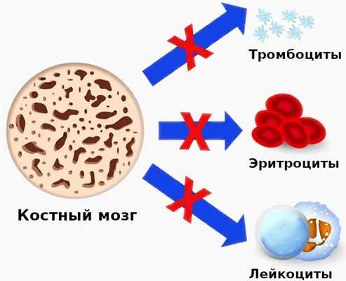 Апластическая анемия